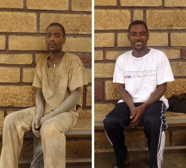 Before and after — the impact of our shower service on a patient